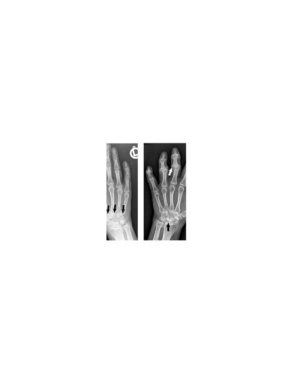 Rummy FAQ: What Does a Stable Hand Look Like?