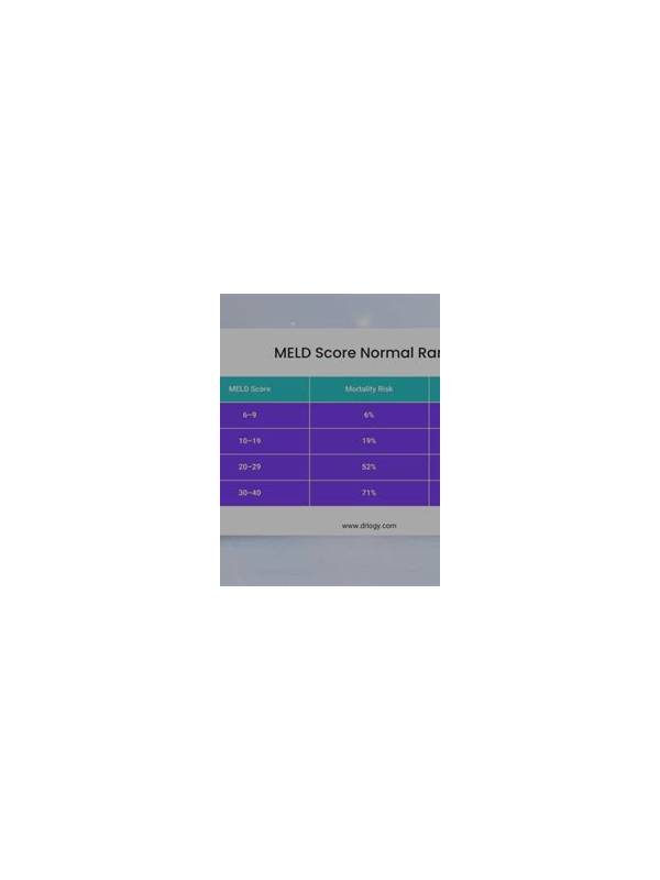 Rummy Guide: Measure Flexibility Before Choosing a Meld
