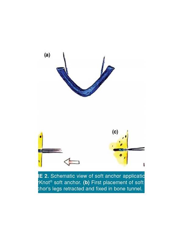 Rummy Comparison: One Strong Anchor Versus Several Loose Anchors
